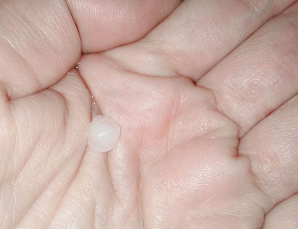 Χαλάζι στην Αθήνα